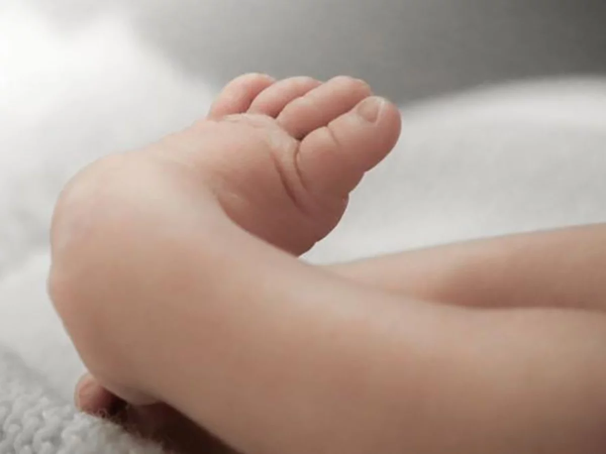 Pie Equino Congénito - Causas y opciones de tratamiento desde el nacimiento