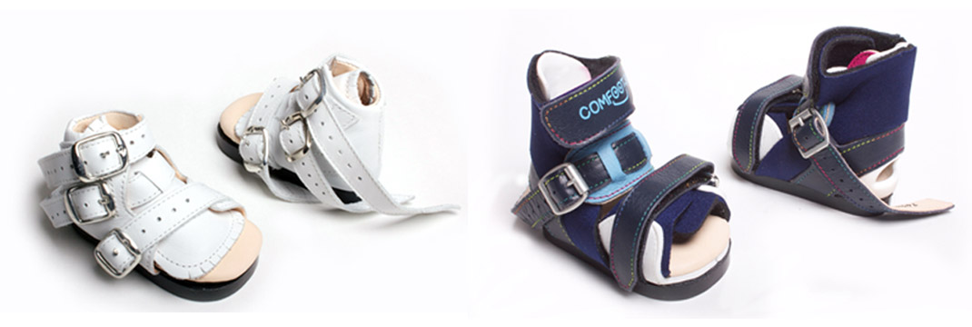 Adaptaciones en el calzado para Pie Equino - Comodidad y soporte para caminar